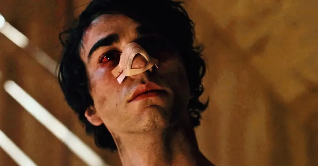 hereditario alex wolff ferido Alex Wolff como Peter em cena do filme de terror Hereditário (2018), com rosto machucado e nariz quebrado com curativo - ator se machucou durante as filmagens