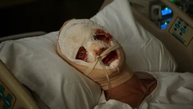 cara de barro 2026 teaser Teaser de Cara-de-Barro mostra personagem com rosto enfaixado em leito hospitalar após desfiguração