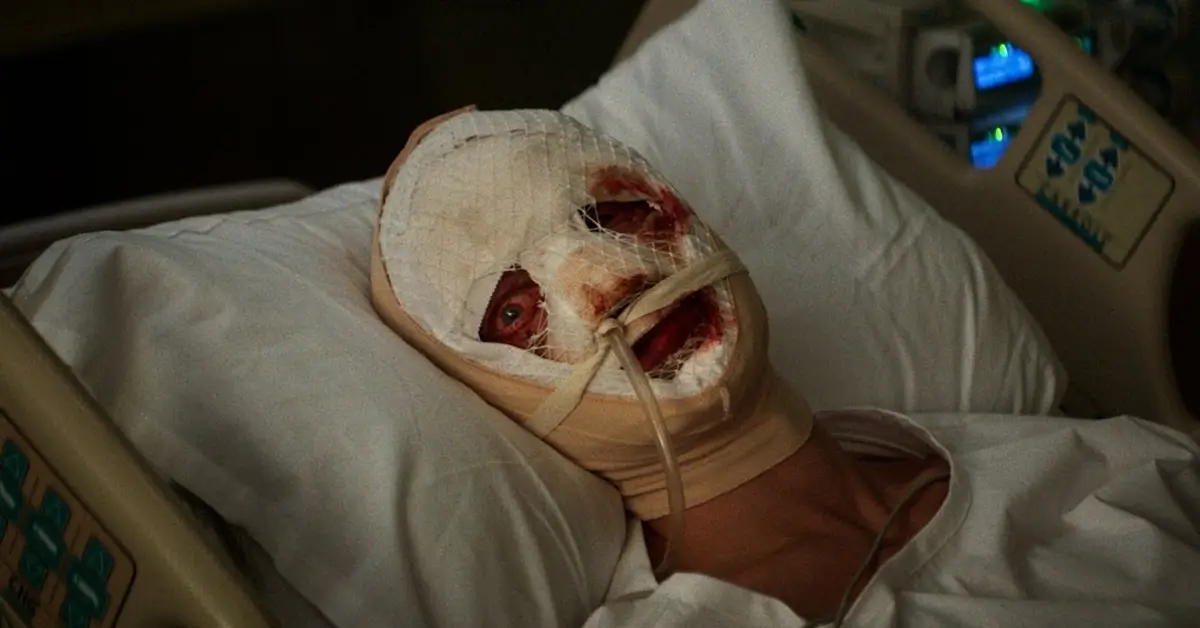 cara de barro 2026 teaser Teaser de Cara-de-Barro mostra personagem com rosto enfaixado em leito hospitalar após desfiguração