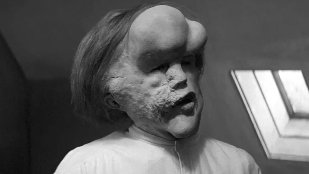 John Hurt como John Merrick em O Homem Elefante (1980), clássico dramático dirigido por David Lynch baseado em uma história real.