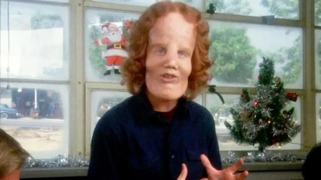 Eric Stoltz como Rocky Dennis em Mask (1985), drama baseado em uma história real sobre superação e preconceito.