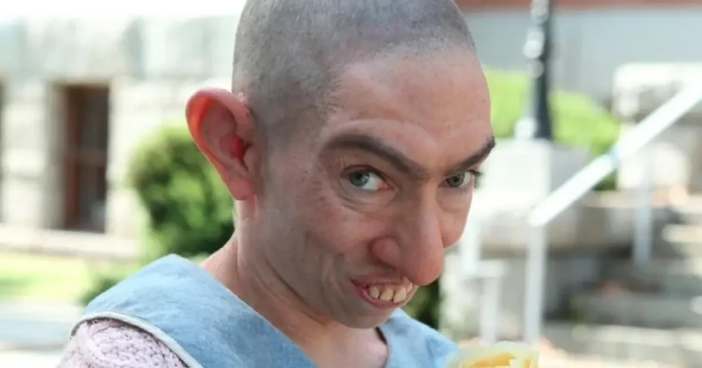 Pepper interpretada por Naomi Grossman em American Horror Story